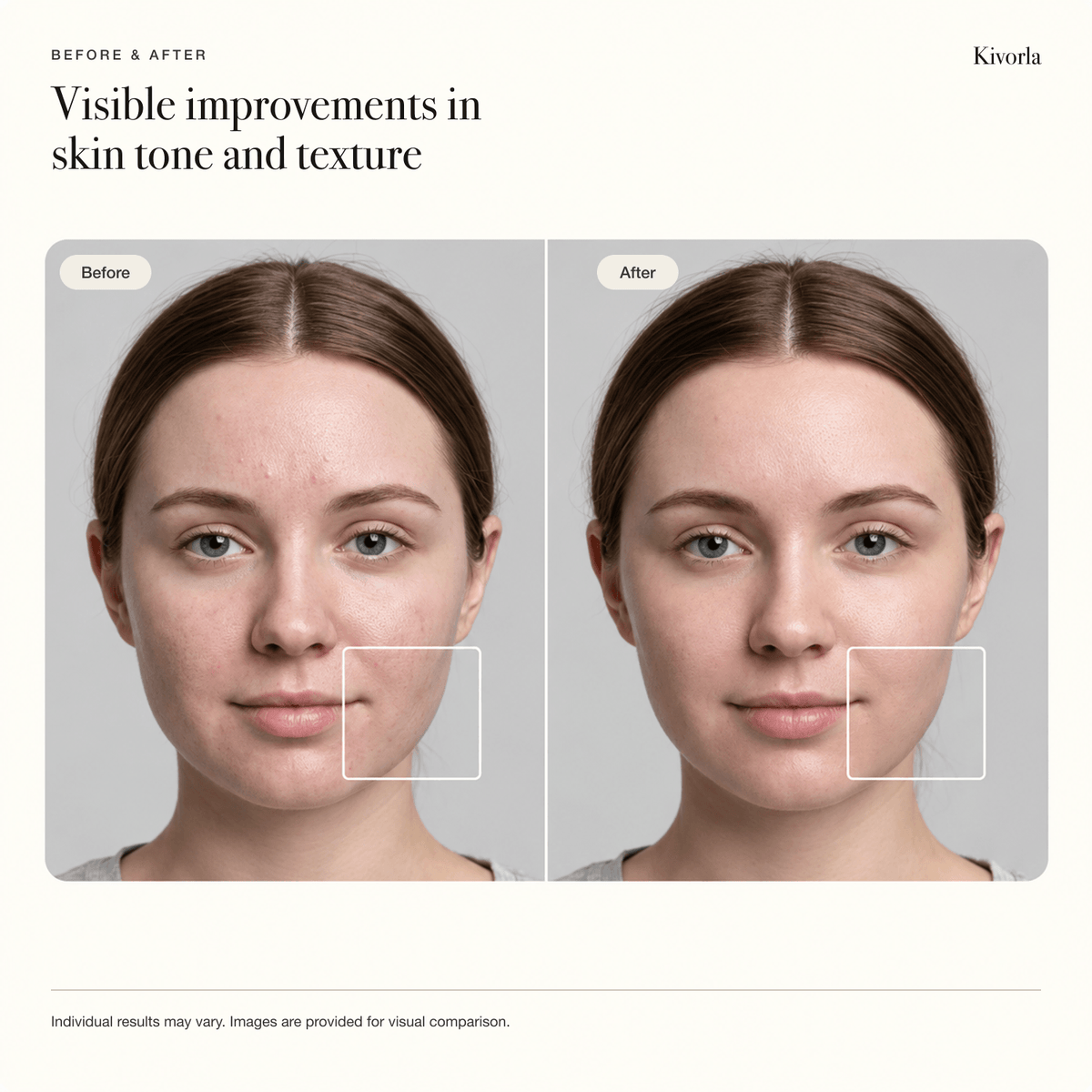 Before-and-after comparison of a woman's facial skin